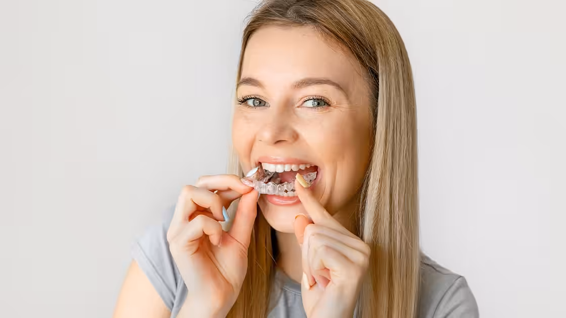 Aligner 2